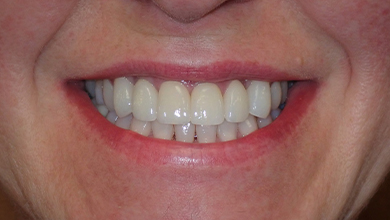 Close up of woman with evenly spaced teeth