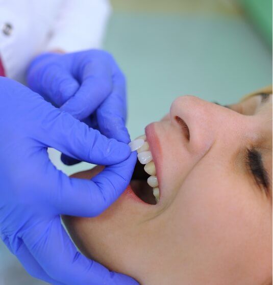 Man receiving a veneer from his cosmetic dentist