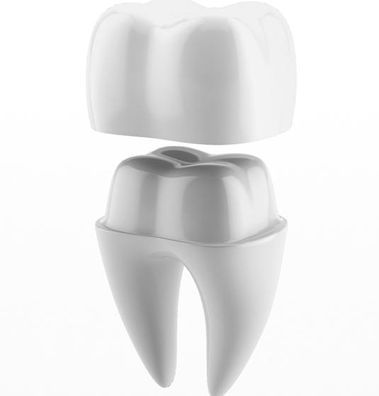 Illustration of a dental crown in Jacksonville, FL