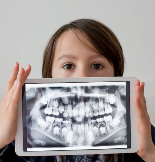 Child holding tablet showing dental x rays in front of their face