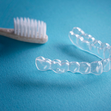 Keep your Altenbach clear aligners clean with a soft bristled toothbrush and hand soap