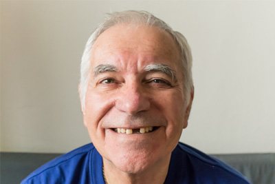 Patient in Beauclerc with missing tooth