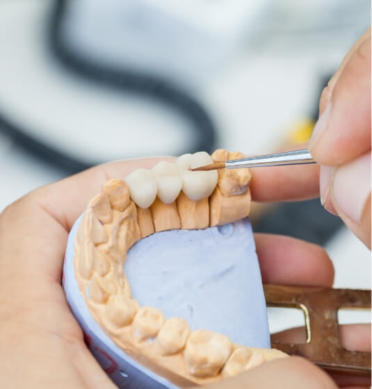 Dentist designing a dental bridge to replace missing teeth in Jacksonville