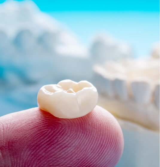 Dentist holding dental crown in Jacksonville on their finger