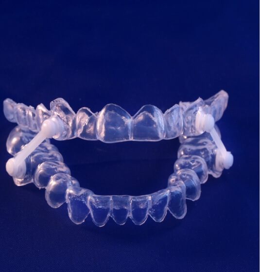 Clear oral appliance for sleep apnea treatment