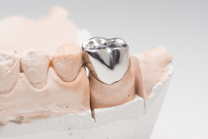 metal crown on a dental model